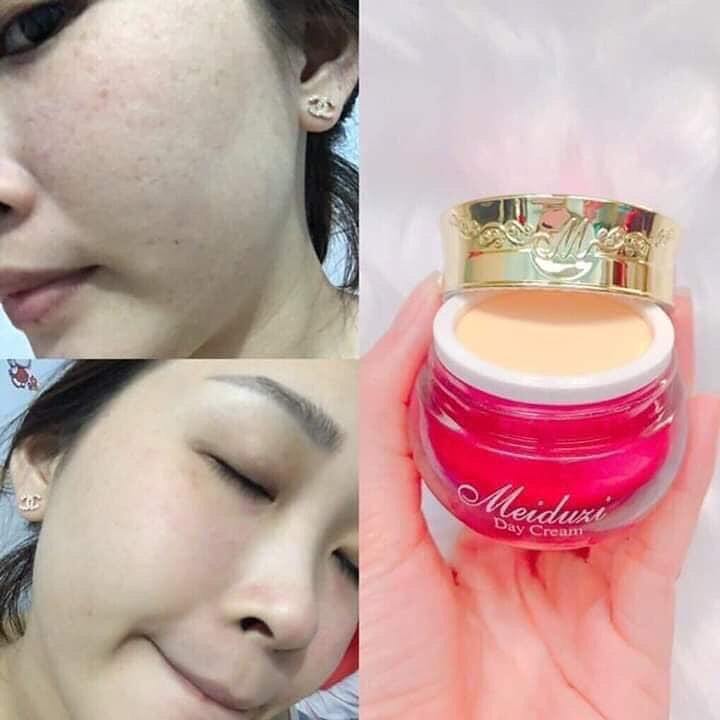 Kem dưỡng trắng, ngăn ngừa nám, tàn nhang Meiduzi Day Cream