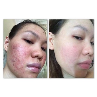 Detox Hồng Sâm DR CELL 50ml tái tạo da mờ thâm nám giảm mụn