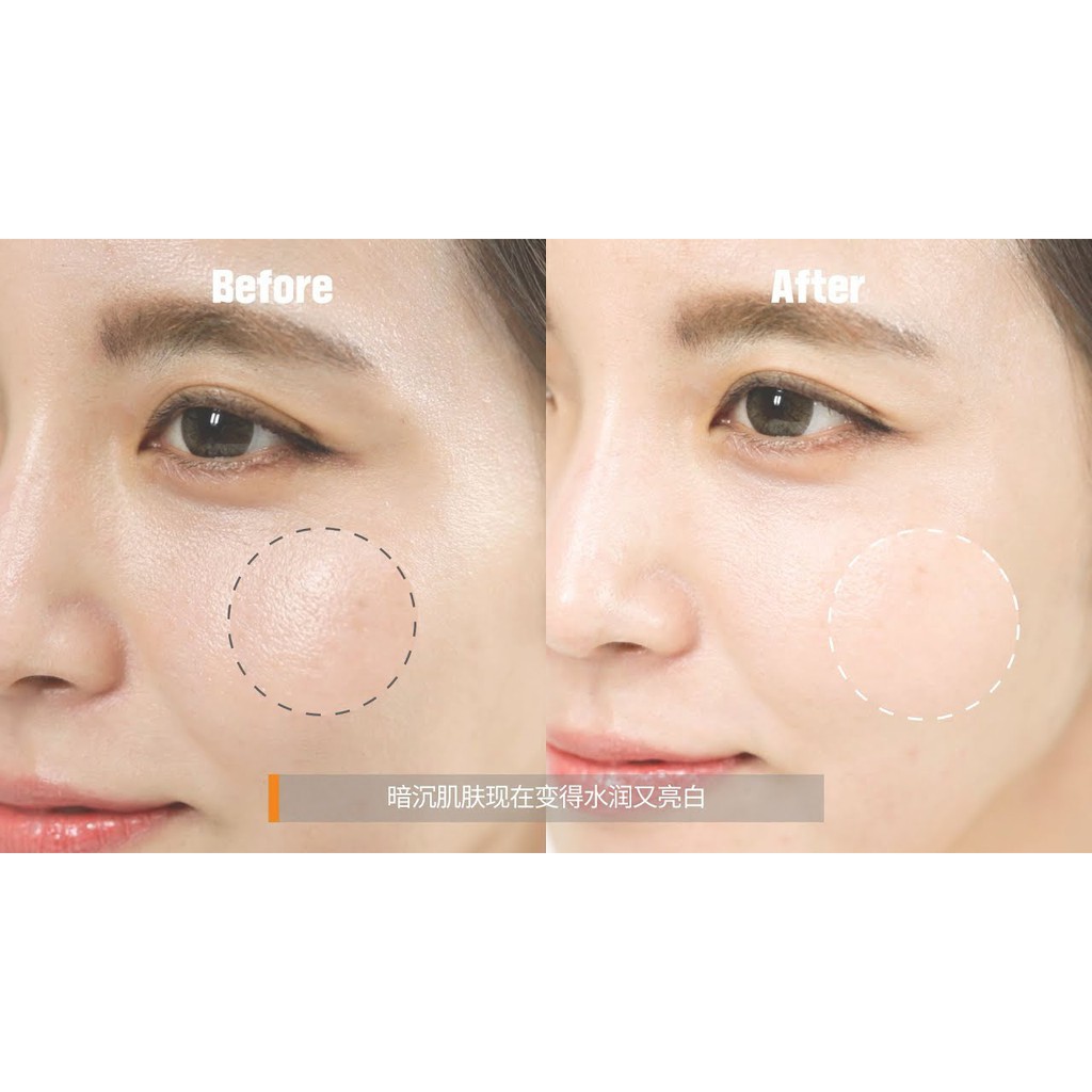 Miếng Dán Mụn Cosrx Acne Pimple Master Patch 24 miếng