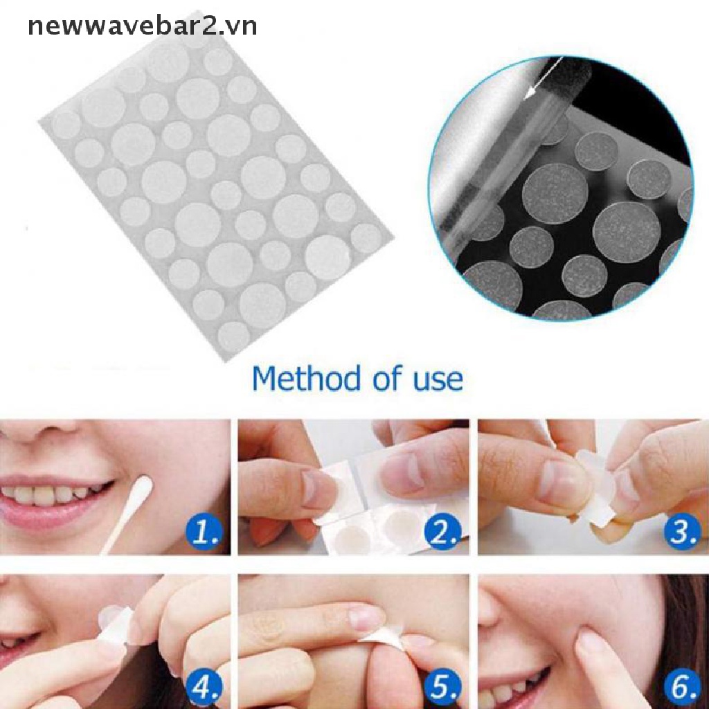 Bộ 36 Miếng Dán Hỗ trợ giảm mụn Trứng Cá Tiện Dụng