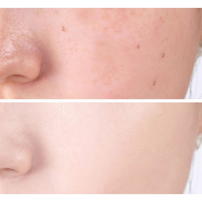 KEM CHE KHUYẾT ĐIỂM YANGMEI 2,7G NỘI ĐỊA TÔNG MÀU PHÙI HỢP LÀN DA CHÂU Á MÀU NHẸ NHÀNG TỰ NHIÊN CHE PHỦ TỐT BỀN LÂU | BigBuy360 - bigbuy360.vn