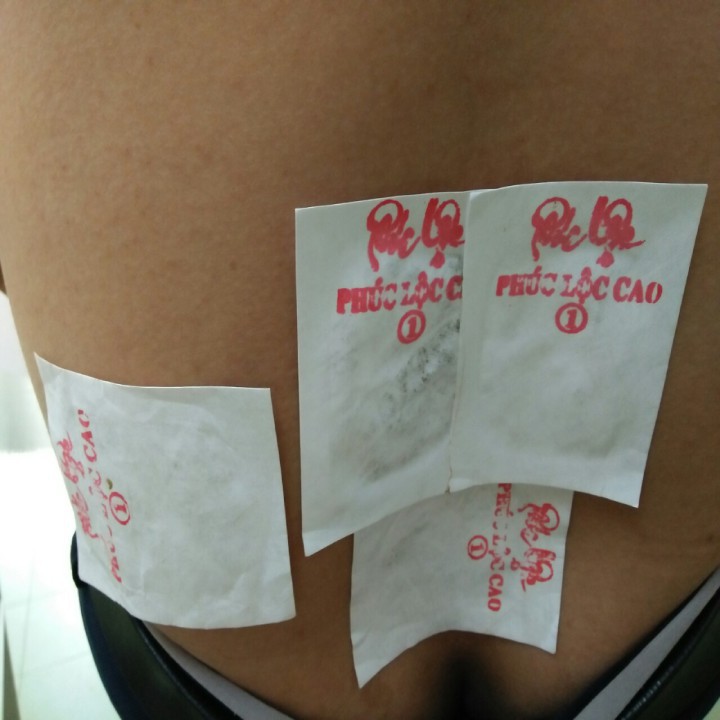 Cao dán xương khớp PHÚC LỘC