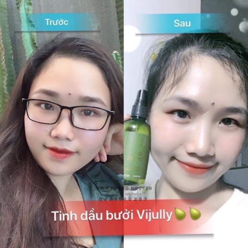 [ CHÍNH HÃNG VI JULLY 100%] Tinh Dầu Bưởi Vijully Kích Mọc Tóc, Giảm Gãy Rụng, Giúp Tóc Bóng Mượt Chắc Khoẻ | BigBuy360 - bigbuy360.vn