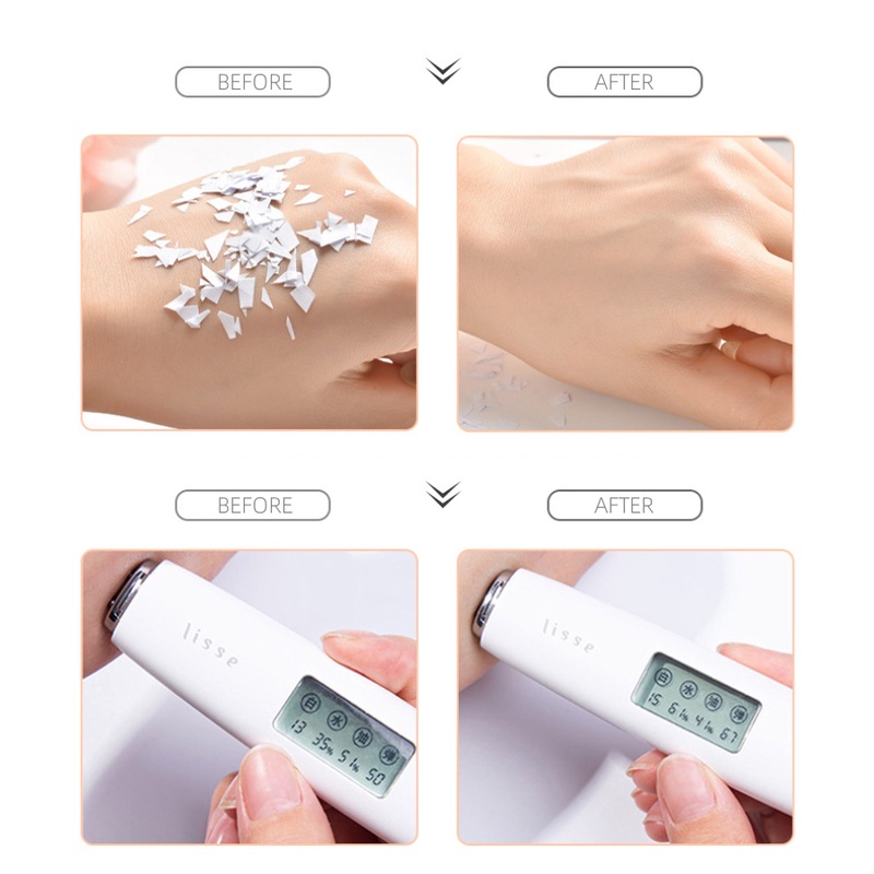 Gel lót trang điểm QISE dưỡng ẩm kiềm dầu che khuyết điểm lỗ chân lông | BigBuy360 - bigbuy360.vn