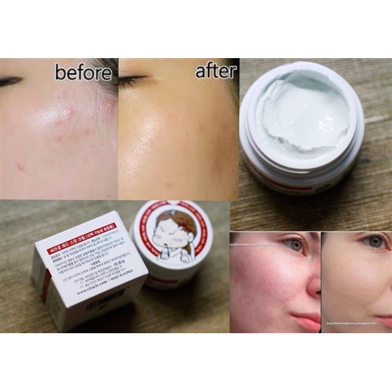 Kem Mụn Và Giảm Thâm Ciracle Red Spot Cream | BigBuy360 - bigbuy360.vn