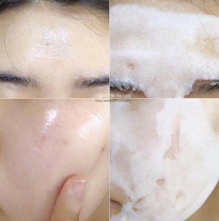 (CHÍNH HÃNG) Set 10 gói sample Mặt nạ sủi bọt thải độc  Su:m