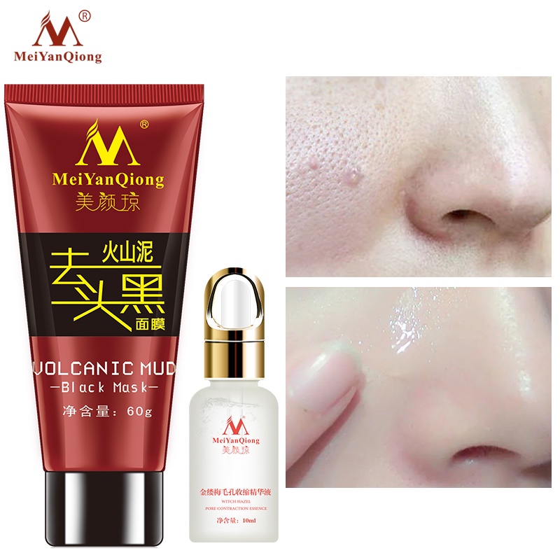 Bộ Mỹ Phẩm Chăm Sóc Da MeiYanQiong Gồm Mặt Nạ Bùn Núi Lửa Và Serum Se Khít Lỗ Chân Lông Giúp Tẩy Mụn Đầu Đen