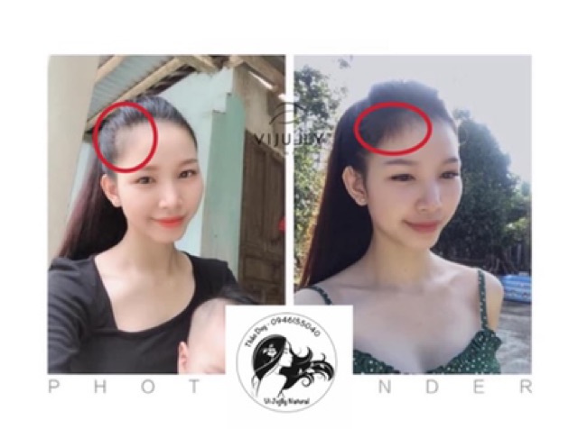 TINH DẦU BƯỞI VI JULLY [Tặng Phụ Kiện Tóc Xinh] - KÍCH THÍCH MỌC TÓC - TRỊ HÓI | BigBuy360 - bigbuy360.vn