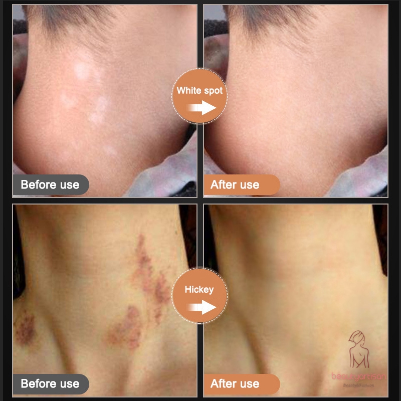 [Hàng mới về] Kem che vết xăm/sẹo 2 tông màu chống nước | BigBuy360 - bigbuy360.vn