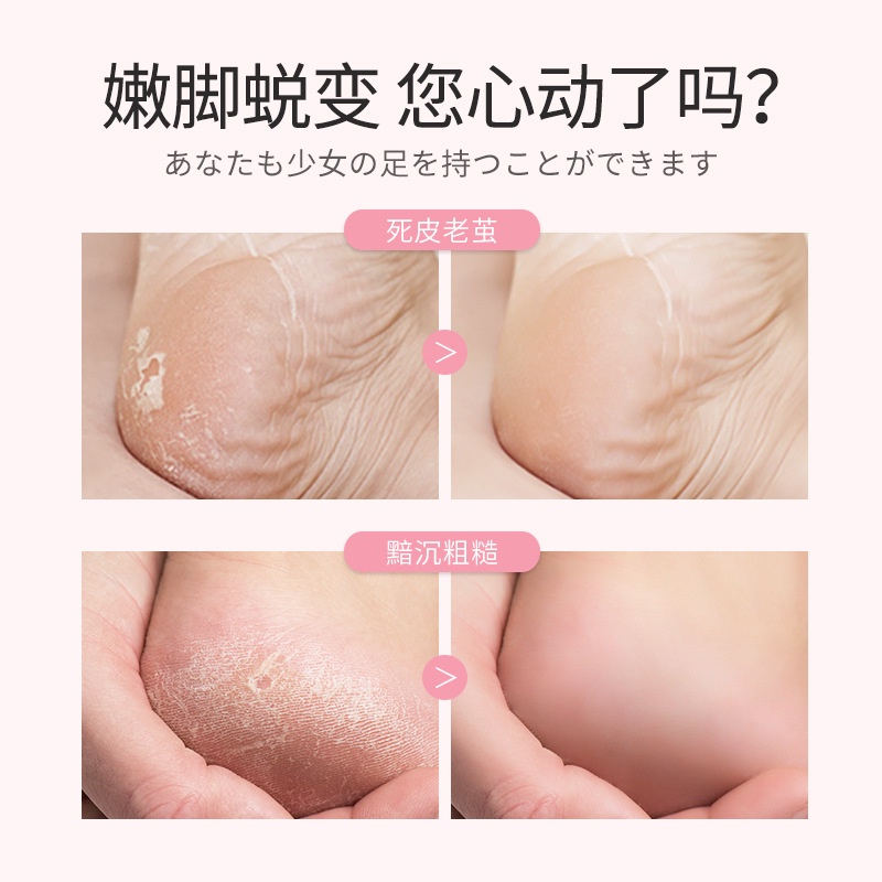 1 Cặp Mặt Nạ Chân Mengxilan Niacinamide Nuôi Dưỡng Và Làm Sáng Da