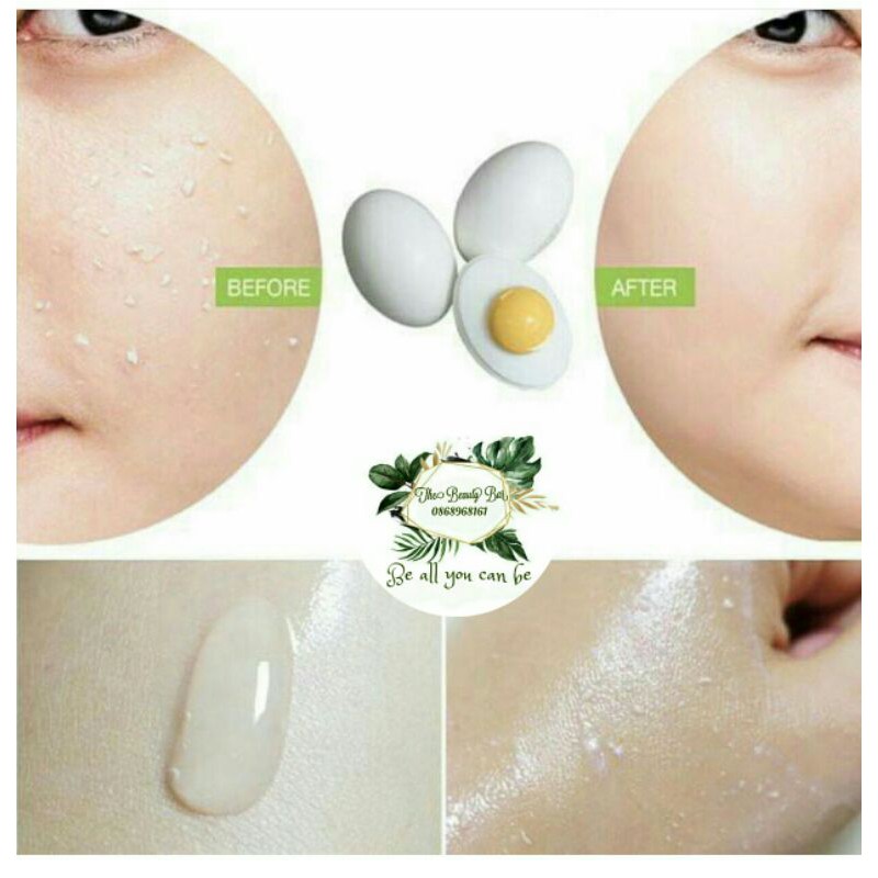 [ Da nhạy cảm ] Gel tẩy da chết Holika Holika Smooth Egg Skin Peeling Gel 140ml nhập khẩu Hàn Quốc