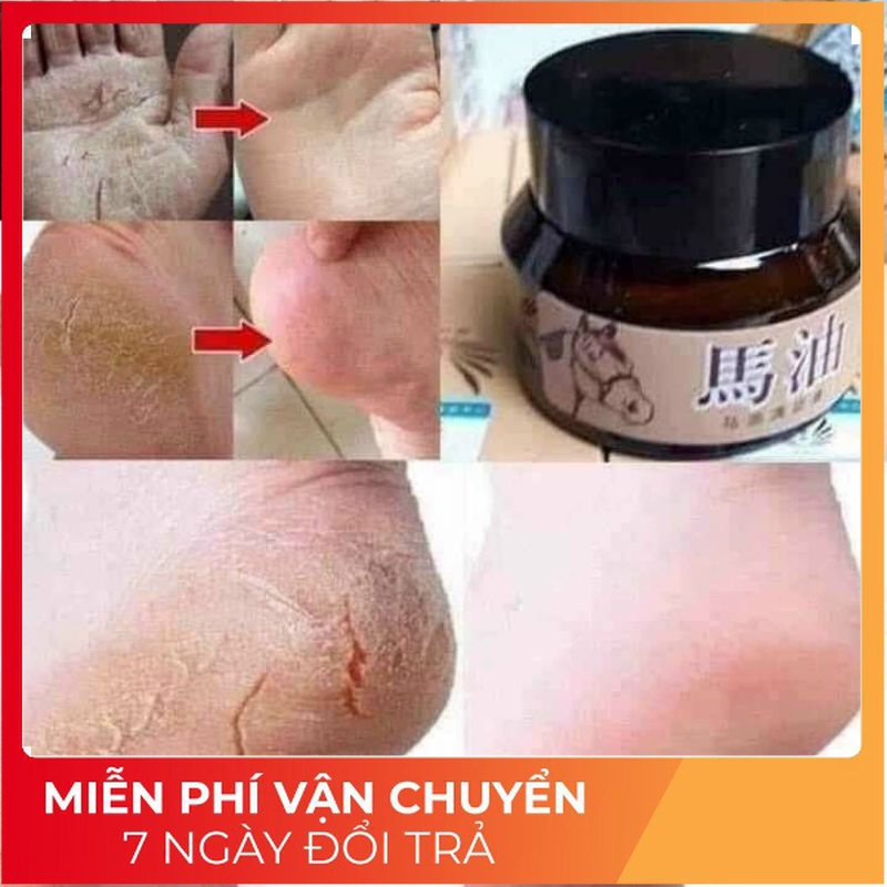 Kem Dầu Ngựa Nứt Gót Chân, Nẻ Da Tay Hàng Chất Lượng 30gr