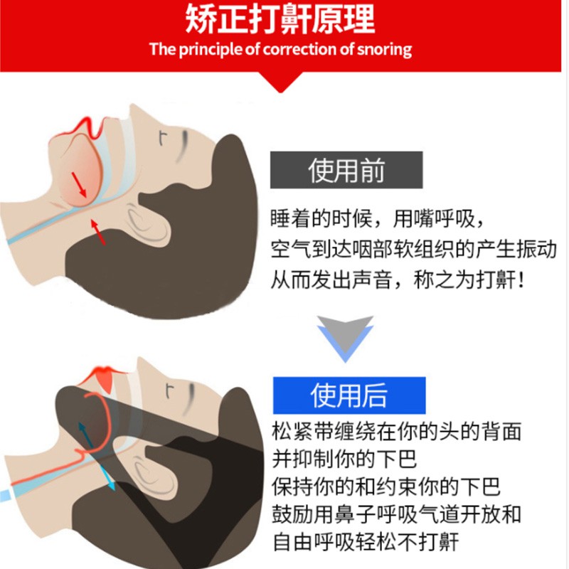 Đai Đeo Cằm Chống Ngáy Khi Ngủ Chống Ngáy Hai Màu Đen / Xanh Dương