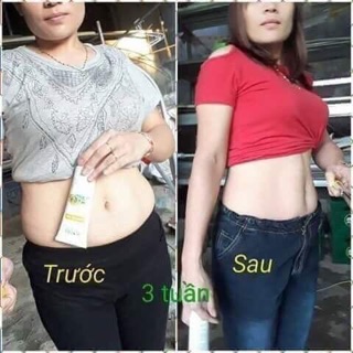Gel Tan Mỡ Mother & Care