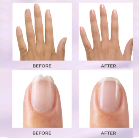 Bộ Thiết Bị Mài Giũa Móng Tay 5 Trong 1 Cao Cấp Sạc Điện