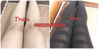 GEN NỊT GIẢM MỠ SĂN CƠ MÔNG, ĐÙI, BẮP CHÂN