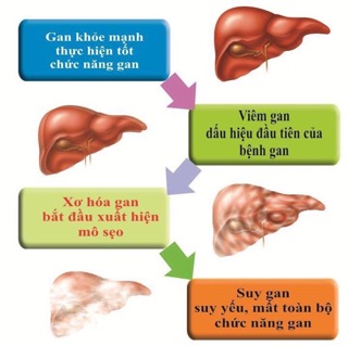 Thải độc gan Arkopharma 20 ống của Pháp