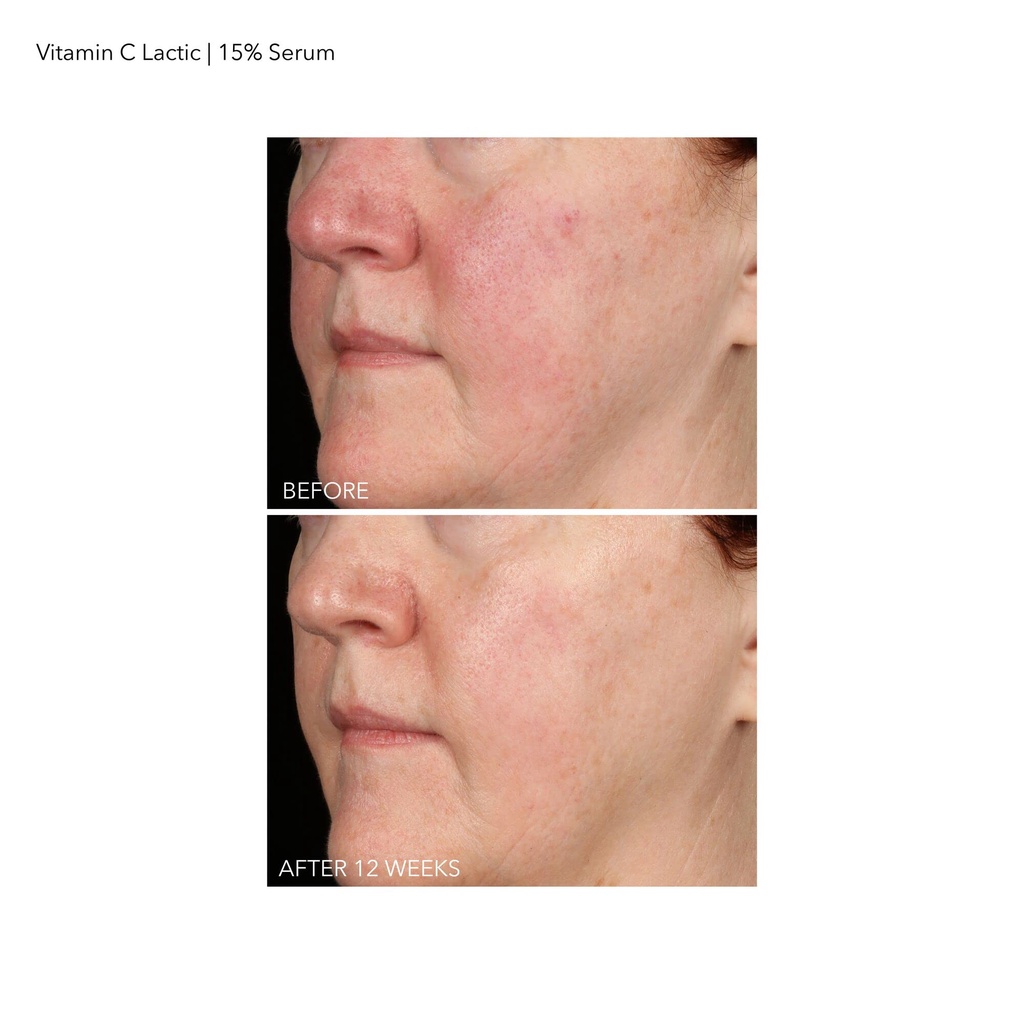 Serum sáng da chống lão hóa Dr. Dennis Gross Vitamin C Lactic Acid 15% Firm &amp; Bright Serum 7ml