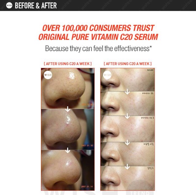 SERUM OST SERUM VITAMIN C21,5 CHO DA THÂM VÀ MỤN