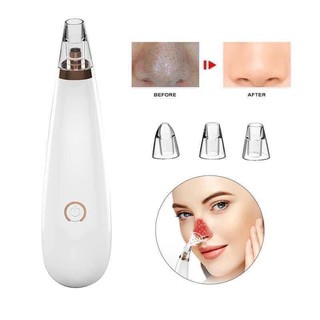 MÁY HÚT MỤN SIÊU SẠCH