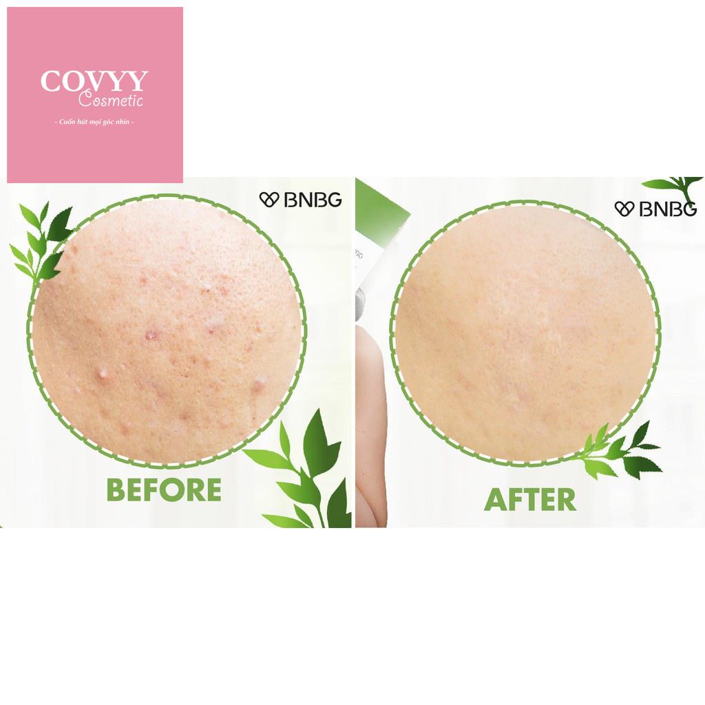 Mặt nạ cấp ẩm dưỡng trắng da BNBG Mask 30ml