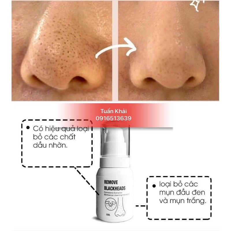 Ủ mụn đầu đen Remove BlackHeads ONMACABIM