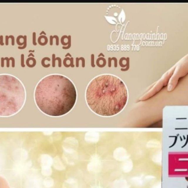 Kem trị viêm lỗ chân lông