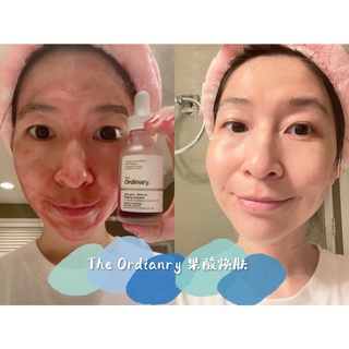 AHA 30% + BHA 2% Peeling Solution the Ordinary - Peeling The ordinary Canada