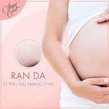 ✅ [CHÍNH HÃNG] Happy Event - Sữa chống rạn da cho mẹ bầu