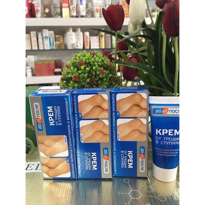 Kem nứt nẻ gót chân Kpem Apteka Nga 50ml