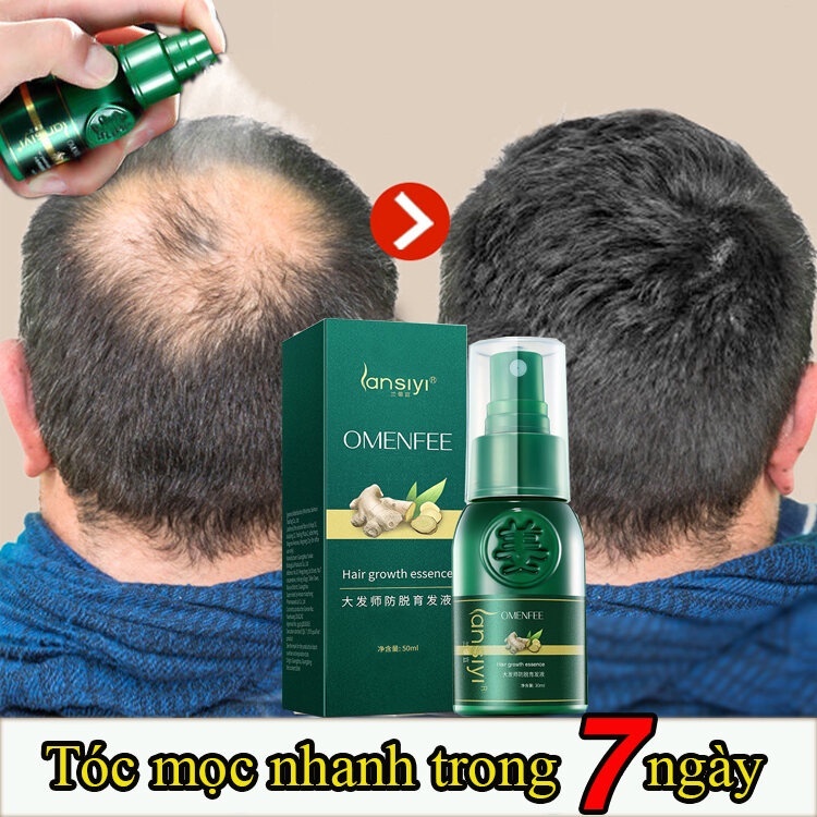 Xịt kích mọc tóc tinh dầu mọc tóc dưỡng tóc và ngăn ngừa rụng tóccó hiệu quả nhanh