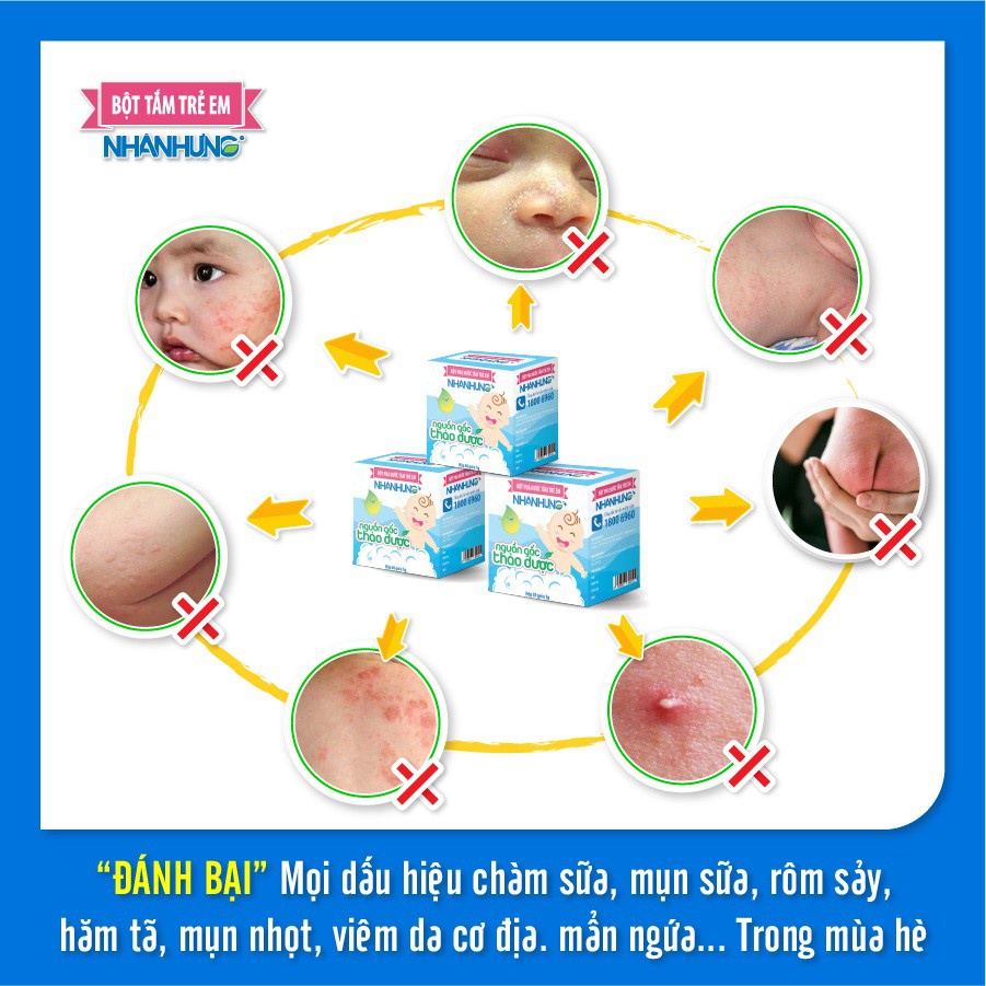 Bột tắm nhân hưng - Sạch hết rôm sảy mẩn ngứa - Hộp 30 gói