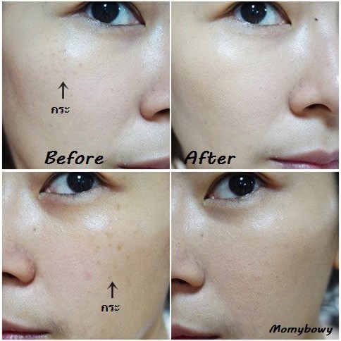 Kem Che Khuyết Điểm Shiseido Spotscover Foundation S100 20g