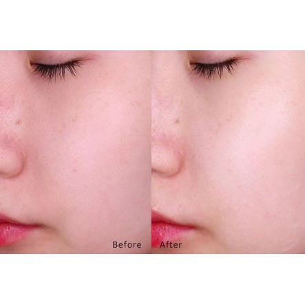 Mặt Nạ Cải Thiện Nếp Nhăn Dongsung Rannce Royal Enrich Mask Pack 25ml