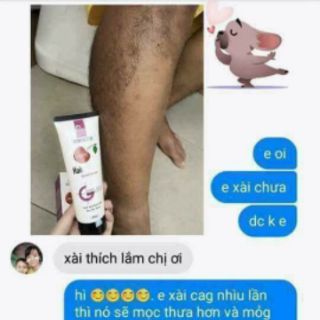 Kem triệt (tẩy) lông mwhite (m'white)