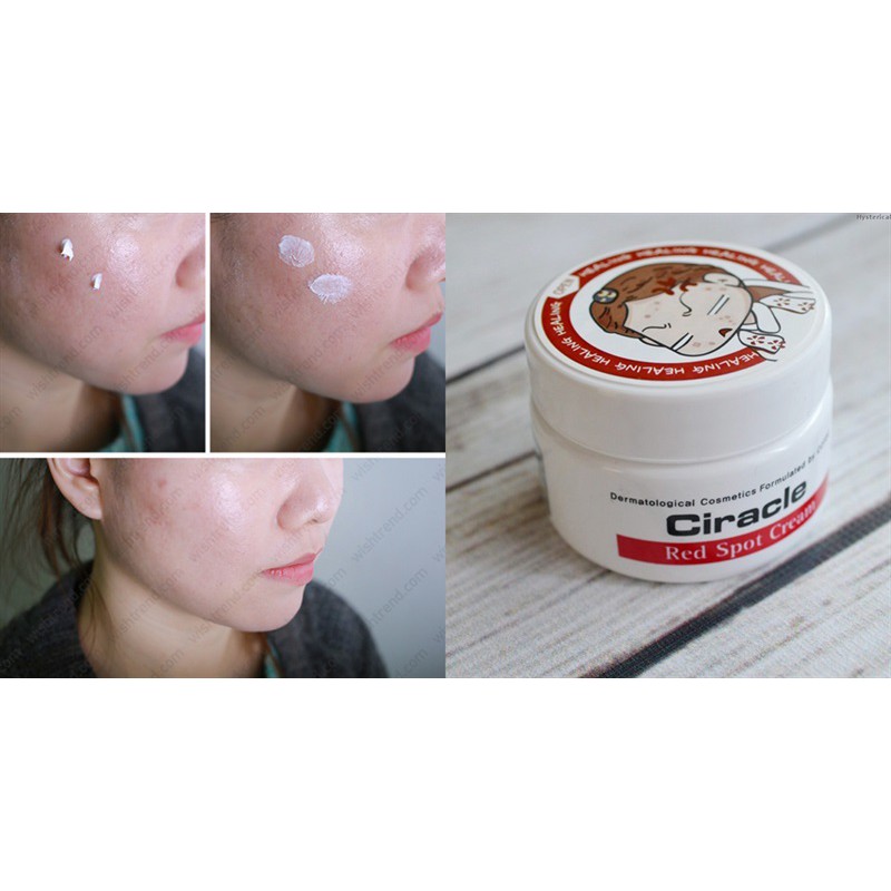 Kem Hổ trợ Giảm Mụn Ciracle Red Spot Cream 30ml Hàn Quốc