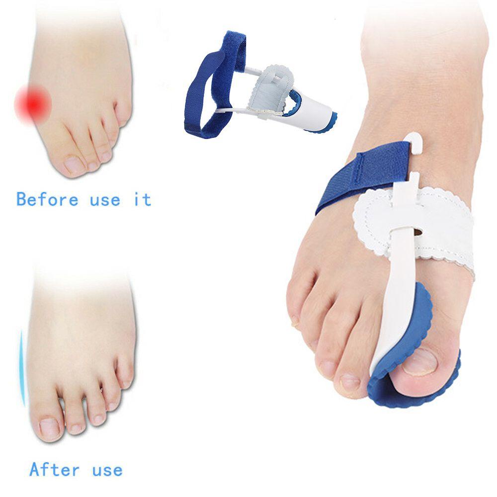 1 Cặp Dụng Cụ Chỉnh Hình Ngón Chân Hiệu Quả