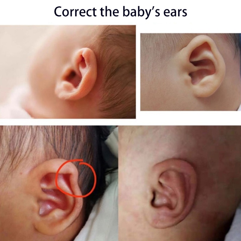 Youyo Tấm Silicone Hỗ trợ giảm sẹo Chống Thấm Nước An Toàn Không Độc Hại Cho Người Lớn Và Trẻ Em Ava