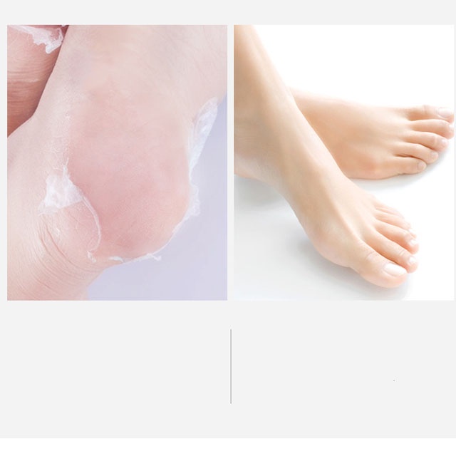 ( Cặp Mặt Nạ ) Ủ Chân/ Tay Sữa Dê Nha Đam Hàn Quốc Lột Da Chết NIACI NAMIDE GOAT FOOT MASK