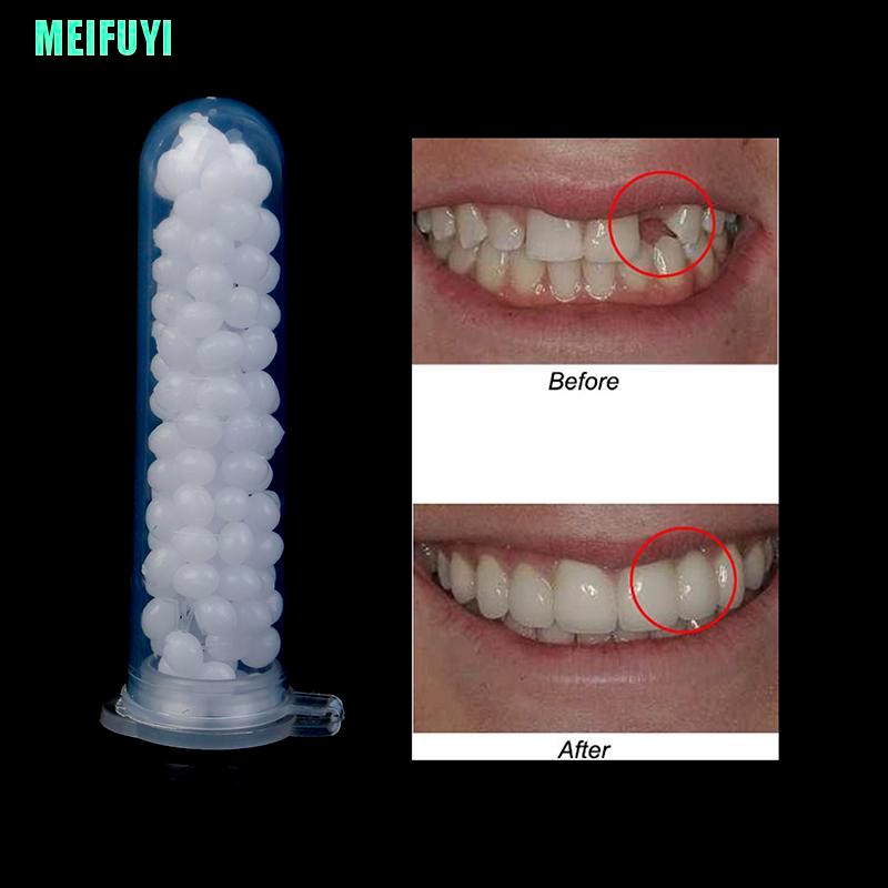 (Hàng Mới Về) Bộ 1 Tuýp Keo Dán Răng Giả 10g Chất Lượng Cao