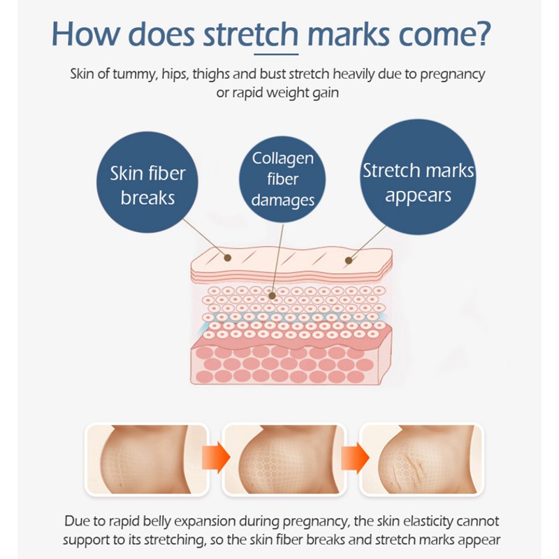 Ready Stock (hàng Mới Về) Kem hỗ trợ giảm Rạn Da Vibrant Glamor Giúp Da Săn Chắc Và Chống Lão Hóa Hiệu Quả COD | BigBuy360 - bigbuy360.vn