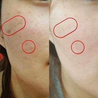 SIRUM JIUHE VUA TRỊ THÂM