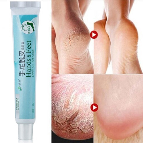Kem hỗ trợ giảm nứt gót chân 20g