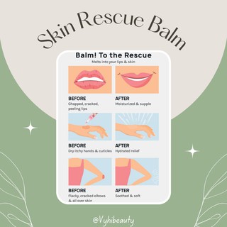 Kem dưỡng đa năng AOA Studio Rescue Balm
