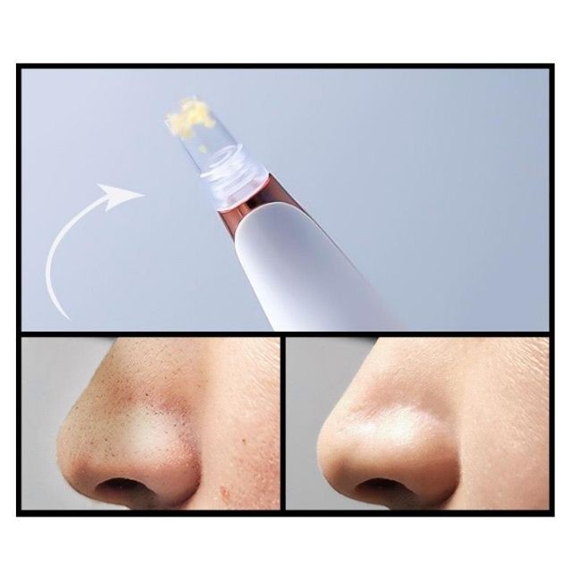 Máy Hút Mụn, Đầu Đen Cám Bọc Cầm Tay Mini Blackhead Spa Hút Nặn Mụn Trứng Cá Tặng 6 Đầu Hút Đa Năng | BigBuy360 - bigbuy360.vn