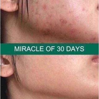 Toner AHA – BHA – PHA 30 Days Miracle