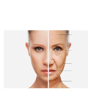 Máy Nâng Cơ Trẻ Hóa Da Hifu V-MAX