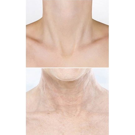 Kem dưỡng da vùng cổ ngừa lão hóa Vella Ultimate Age Killer Neck Cream 50ml