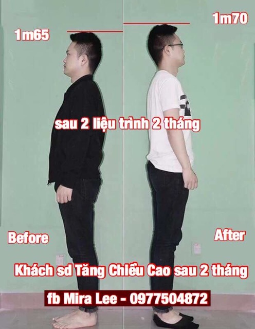 Tinh Chất Tăng Chiều Cao Miracle