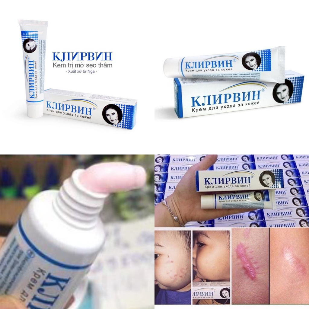 Kem bôi sẹo lồi Klirvin Của Nga Kjinpbnh 25Gram - Sản Phẩm Chính Hãng